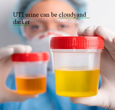 UTI urine can be cloudyand  darker