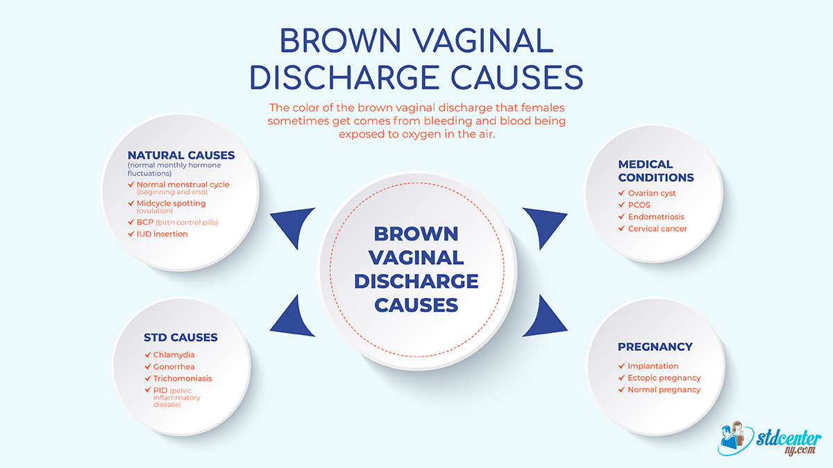 Brown vaginal discharge causes