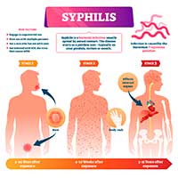 Herpes vs Syphilis