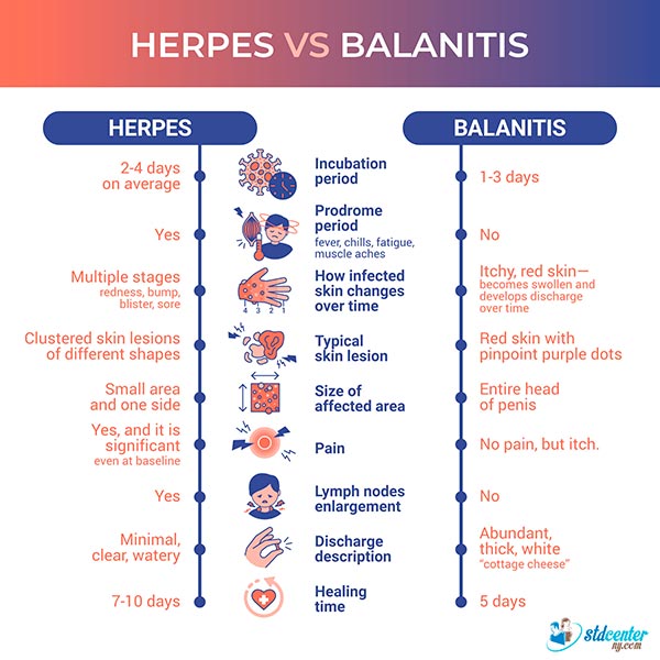This infographic provides a summary of the comparison between genital herpes and balanitis.