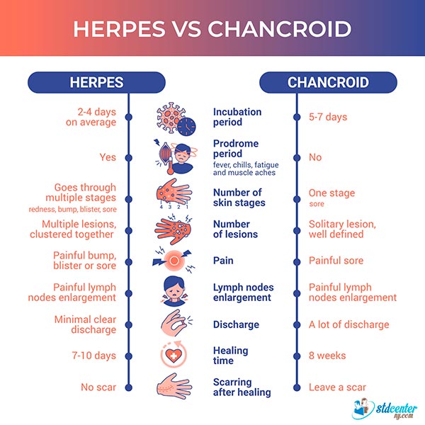 This infographic provides a summary of the comparison between genital herpes and chancroid.