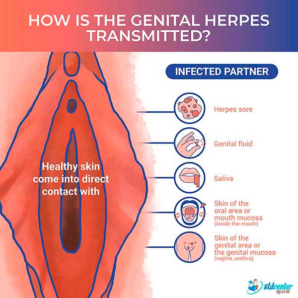 herpes male genitalia
