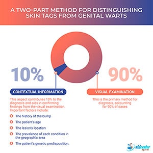 A two-part method for distinguishing skin tags from genital warts.