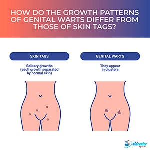 How do the growth patterns of genital warts differ from those of skin tags?