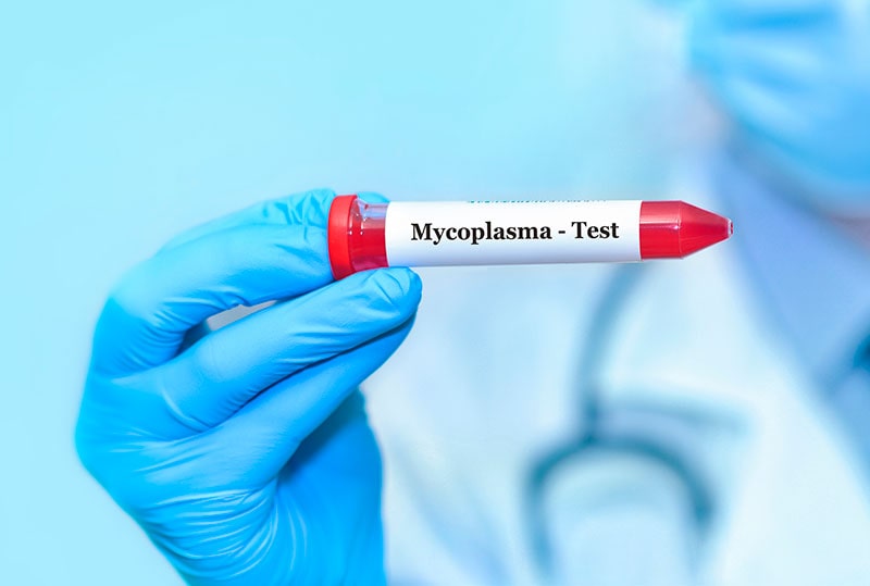 Mycoplasma Hominis testing