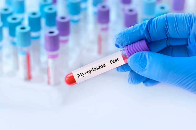 How to test for Mycoplasma genitalium