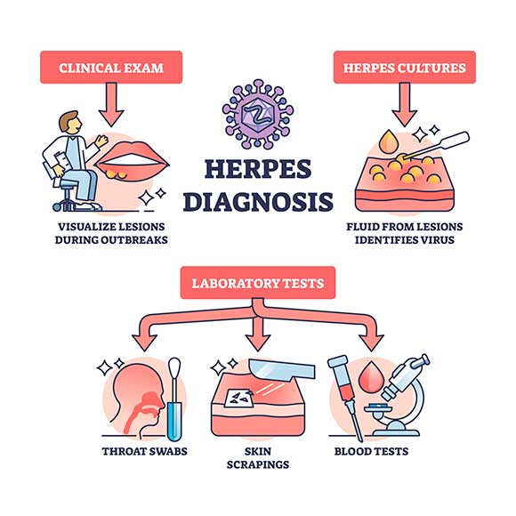 What does herpes look like?