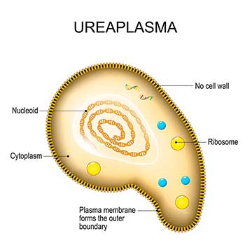 What is ureaplasma?